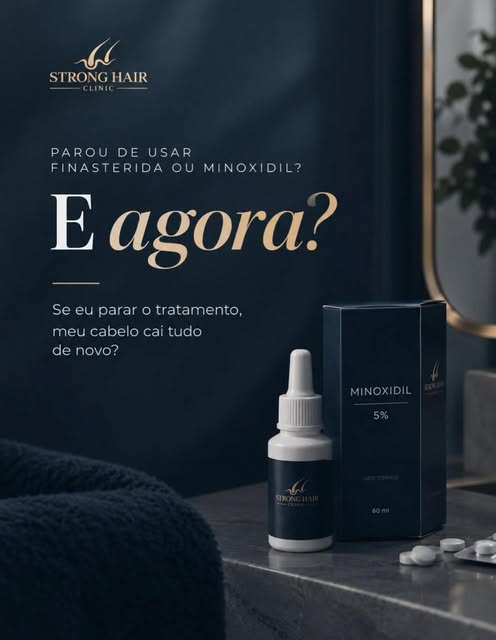 “Se eu parar a finasterida ou o minoxidil, meu cabelo vai cair tudo de novo?”

Não necessariamente. 