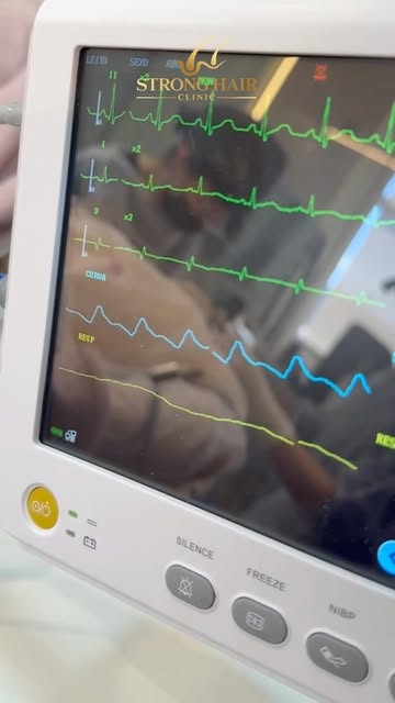 Mais um dia de transplante capilar por aqui! 💙

Alguns registros de mais um procedimento realizado 