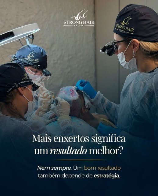 Mais enxertos nem sempre significam mais cabelo.

Parece óbvio pensar que quanto mais enxertos forem