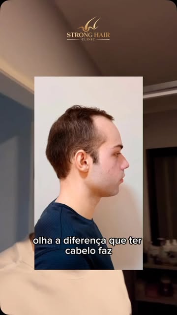 O transplante foi só o começo. Agora, seguimos acompanhando de perto cada etapa dessa evolução. 

O 