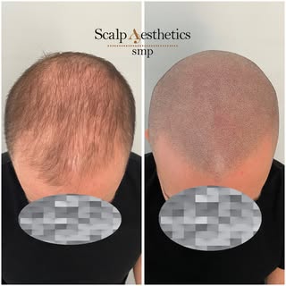✨ BRAVED THE SHAVE ✨
Say hello to confidence! 💪 Our amazing client took the leap and embraced the b