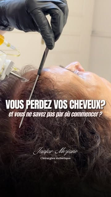 Perte de cheveux : il n’existe pas qu’une seule solution.

Toutes les options sont dans la vidéo.

Q