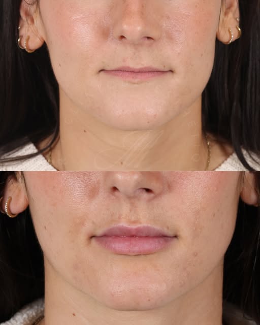 3 résultats - 3 styles - 1 seule question :

vous êtes plutôt team “naturel et discret » ? ou team «
