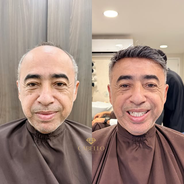 ✨Cliente feliz e satisfeito é o que desejamos sempre! 

Ele ficou mais jovem, mais bonito e com auto