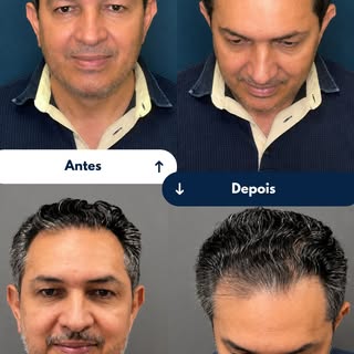 O Chico viveu essa experiência e decidiu contar como foi.

Mais do que mostrar um resultado, esse de