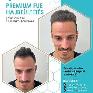 ✨ Marci átalakulása egyszerűen lenyűgöző! ✨
A Mickey-egeres kopaszodás már csak emlék – helyette mos