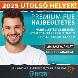 🔥 2025 UTOLSÓ HELYEI! 🔥
Ne maradj le a PRÉMIUM FUE hajbeültetésről – az idei helyek rohamosan fogy
