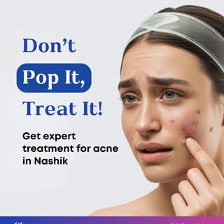 Popping pimples might feel satisfying for a moment—but it’s actually the worst thing you can do for 