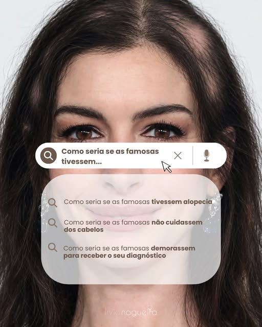 A alopecia afeta milhares de mulheres e traz grandes prejuízos à autoestima.

Um cabelo saudável faz