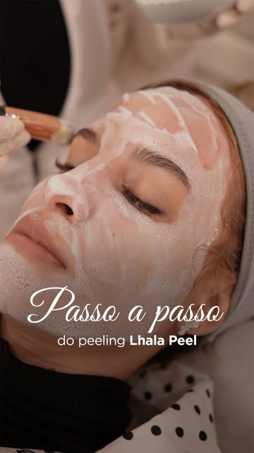 Tratar manchas e acne exige um protocolo personalizado! 

No atendimento da Sophia, associamos o mic