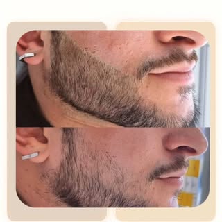 Tenha uma barba cheia e estulosa !!