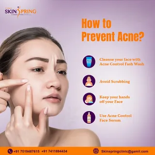 Say no to acne before it starts! 

🔹 Cleanse your face with an acne control face wash
🔹 Avoid hars