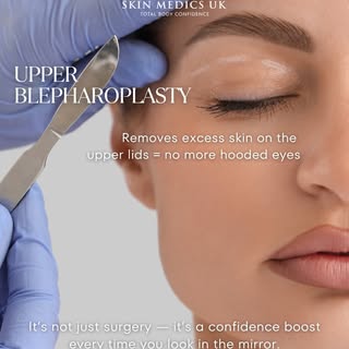 Upper Blepharoplasty at Skin Medics UK

Upper eyelid blepharoplasty, also known as an upper eyelid l
