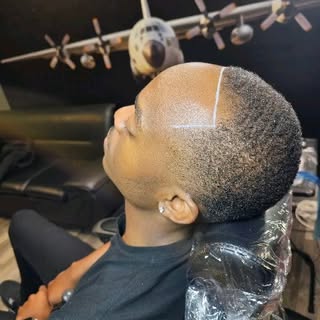 "Say goodbye to hair loss struggle! 🚫✂️ Discover the power of scalp micropigmentation at The SMP Ba
