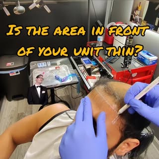 👨‍🎨✨ TRANSFORMATION IN PROGRESS ✨👨‍🎨

Witness the artistry of @smp.barber in action! Scalp Micro