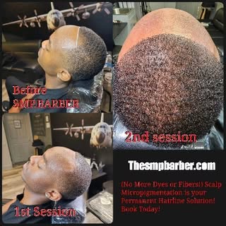 Are you ready to say goodbye to hair loss and hello to a permanent hairline? Look no further!

 SMP 