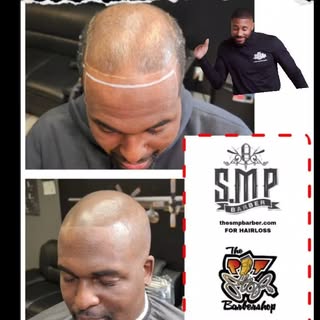 🌟 Introducing Scalp Micropigmentation! 🌟 Are you ready to transform your look and boost your confi