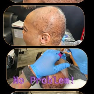 "Embrace your natural beauty and confidence! 💖 Say goodbye to wigs and hello to empowerment with a 
