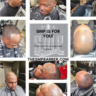 The perfect solution for hair loss due to cancer, alopecia, and FUT/FUE scars. Contact us today at T