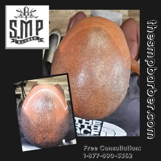Who needs a superhero cape when you can have a flawless hairline? 💪✨ Say goodbye to fibers and dye 