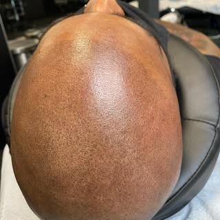 Progress on this Full SMP procedure ✅
••
✔️Free consultations ✔️Guaranteed results
📍7004 Macleod Tr