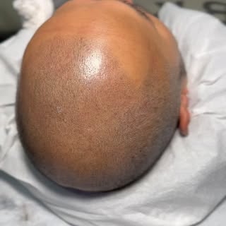 Restoring confidence one scalp at a time 🖤
••
✔️Free consultations ✔️Guaranteed results
📍7004 Macl