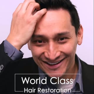 Los Angeles hair transplants. Alvi Armani the #1 rated clinic in America