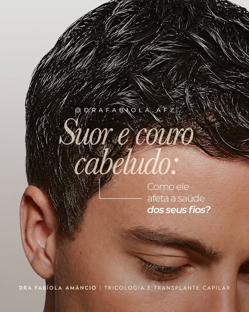 Suor e couro cabeludo: o que a academia pode estar fazendo com os seus fios?

Quem malha com frequên
