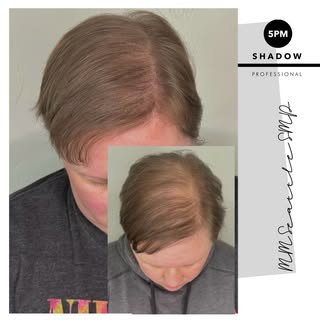 If you’ve ever avoided bright lighting, windy days, or top-down photos because of thinning… you’re n