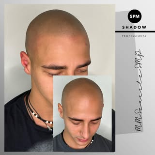 The only hair loss solution that’s  100% effective!

Scalp Micropigmentation Seattle 

Schedule your