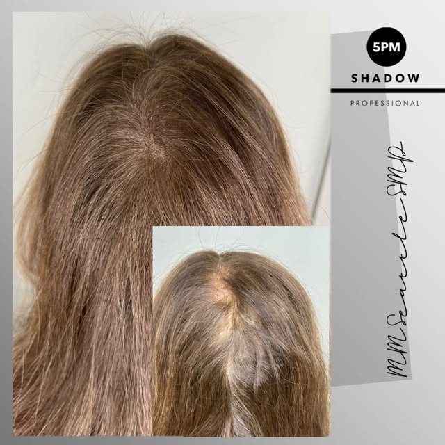 One of our most sought-after treatments: female density fill ✨

This client wanted to soften the app