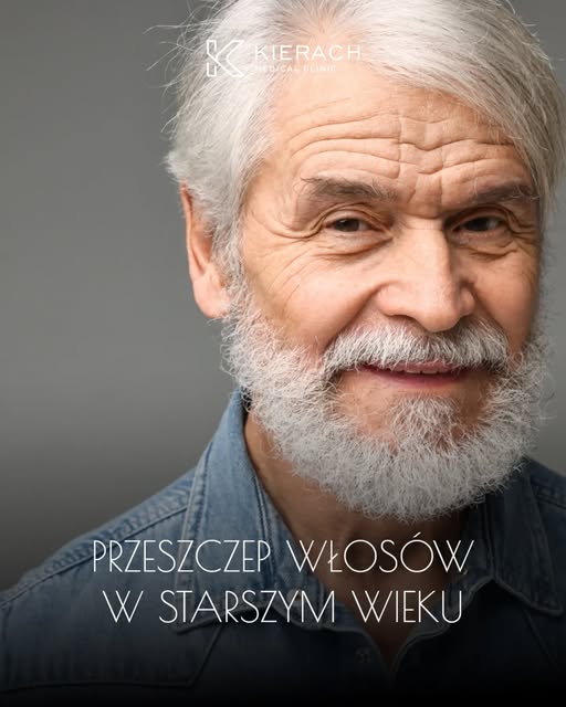 🔬 Przeszczep włosów w starszym wieku - czy to możliwe?

Wiek 👩‍🦳🧑‍🦳 nie musi być przeszkodą w w