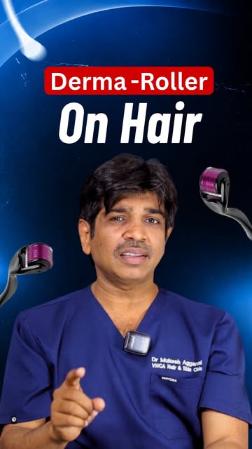 Derma Roller Se Baal Aate Hain Ya Nahi?

Hair loss ke treatment mein Derma Roller ka naam kaafi suna