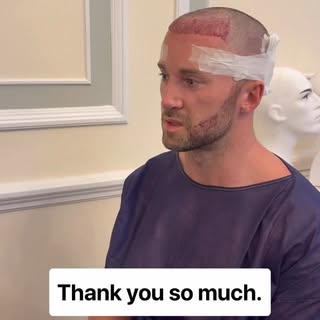 Our patient review #hairtransplant #londonhairtransplant #hairloss #fuehairtransplant #hairtransform