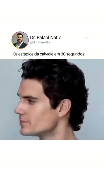 Todo mundo passa pelos mesmos estágios, só que ninguém percebe quando está no primeiro!

A queda com