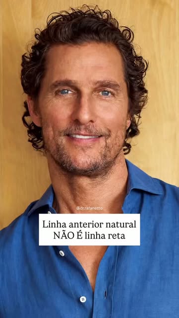 Quando bate o olho e você percebe que é transplante, quase sempre o problema está na linha.

Uma lin