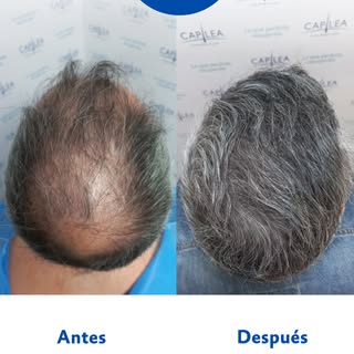 ¿Qué hace falta para lograr un cambio como este?

El deseo de verte y sentirte bien y un equipo de e