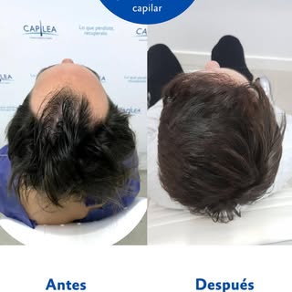Si quieres renovar tu apariencia, ahora es el momento ideal. 💫

Logra tu objetivo y siéntete nuevam