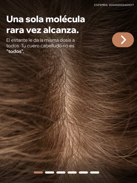 Un producto de estante entrega la misma concentración a todos, sin distinguir el tipo de alopecia ni