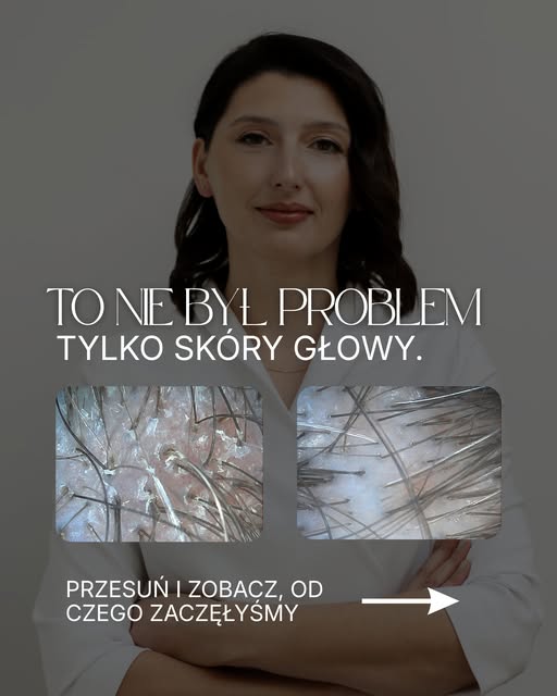 Czasem największa zmiana zaczyna się od tego, że przestajemy traktować skórę głowy jak osobny proble