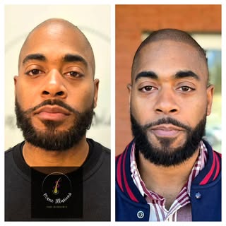 Came in looking for a change, left with a sharp, fresh-cut look! Our scalp micropigmentation (SMP) c