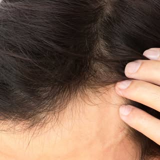 Take a close look at this hair. Can you tell if it is natural or a hair replacement system? Chances 