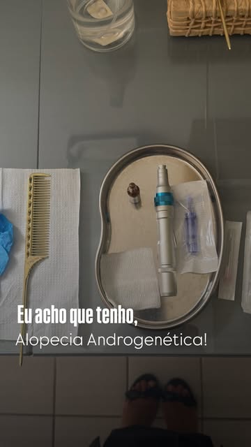 A perda de densidade capilar pode acontecer por diversos fatores e nem sempre o diagnóstico será de 