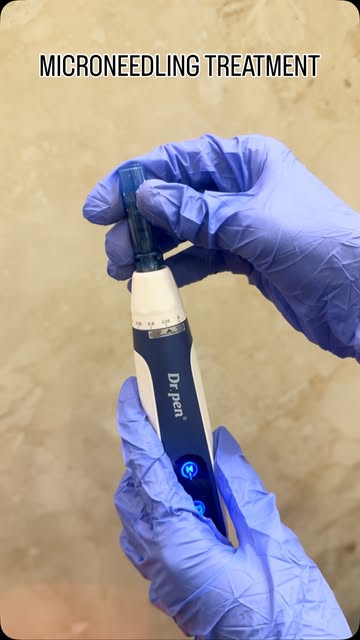 Smoother Skin Starts With the Right Treatment

Microneedling is an advanced skin rejuvenation treatm