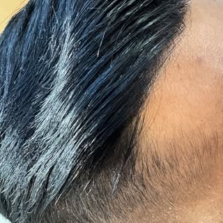 Discover the innovative Skin System – a breakthrough in scalp care and hair restoration technology. 
