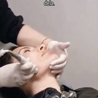 💉O Microagulhamento Robótico Facial é uma tecnologia que utiliza microperfurações controladas para 