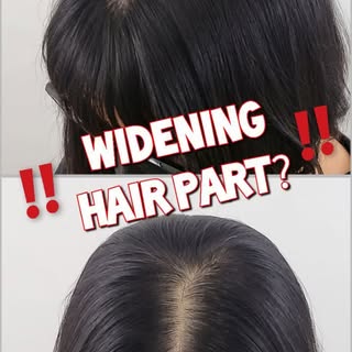 | ADDING DENSITY ON CROWN FOR FEMALE | 여성 가르마 정수리 두피 문신 | Scalp Micro Pigmentation| 미국 뉴욕 한인 SMP 전문 