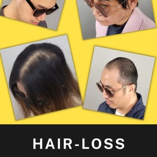 | Hairline SMP for Women in New York | 여성 가르마 정수리 | Scalp Micro Pigmentation| 미국 뉴욕 한인 SMP 전문 두피 문신 