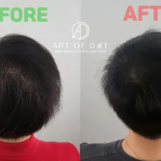 Hair Density for Men Hair Loss | 남자 헤어 정수리 숱채움 | 뉴욕한인 SMP 두피문신 스튜디오 |

#미국두피문신 #미국뉴욕두피문신 #미국smp #kor