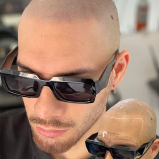 🔥Wow! Check out this Amazing Transformation! Producing the most Natural Results in the game! 3 sess